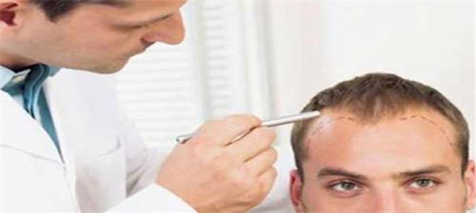 مراكز زراعة الشعر في الأردن